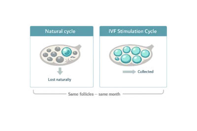 Diagram comparing two ovary illustrations showing follicles lost naturally in a normal cycle versus collected during an IVF