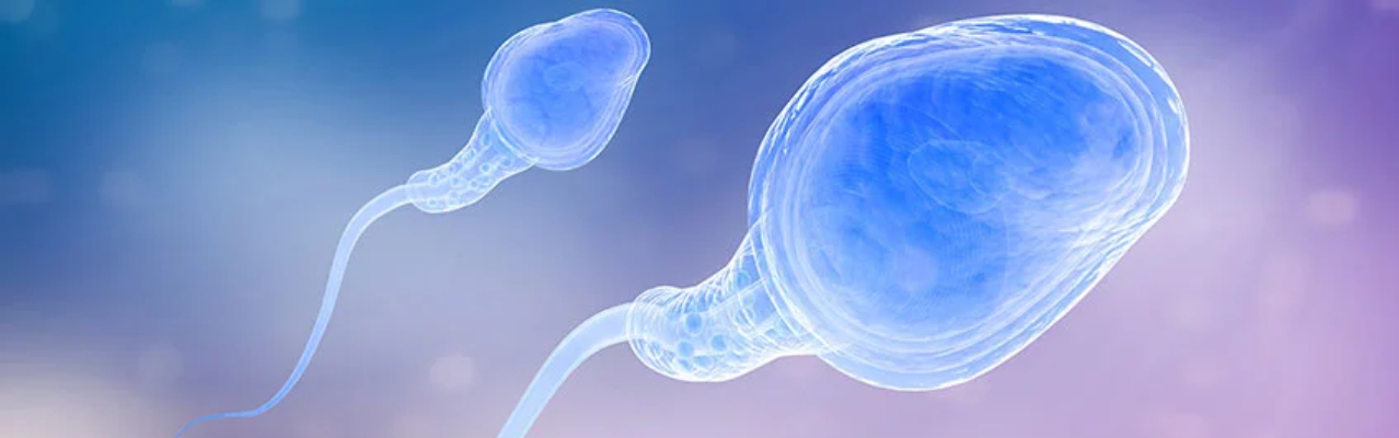 Non-obstructive azoospermia and impaired testicular sperm production explained at Jananam Fertility Centre, Chennai