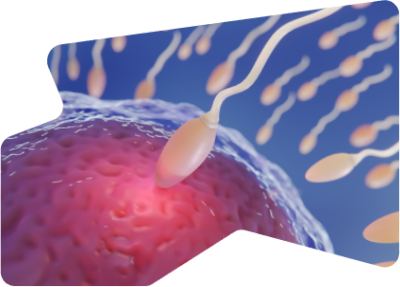 Understanding IUI